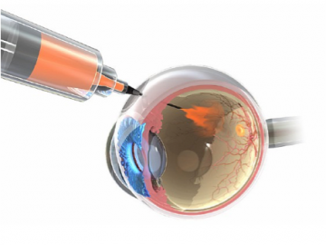 stemcelltherapyprocess